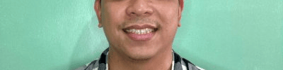 Alvin A.